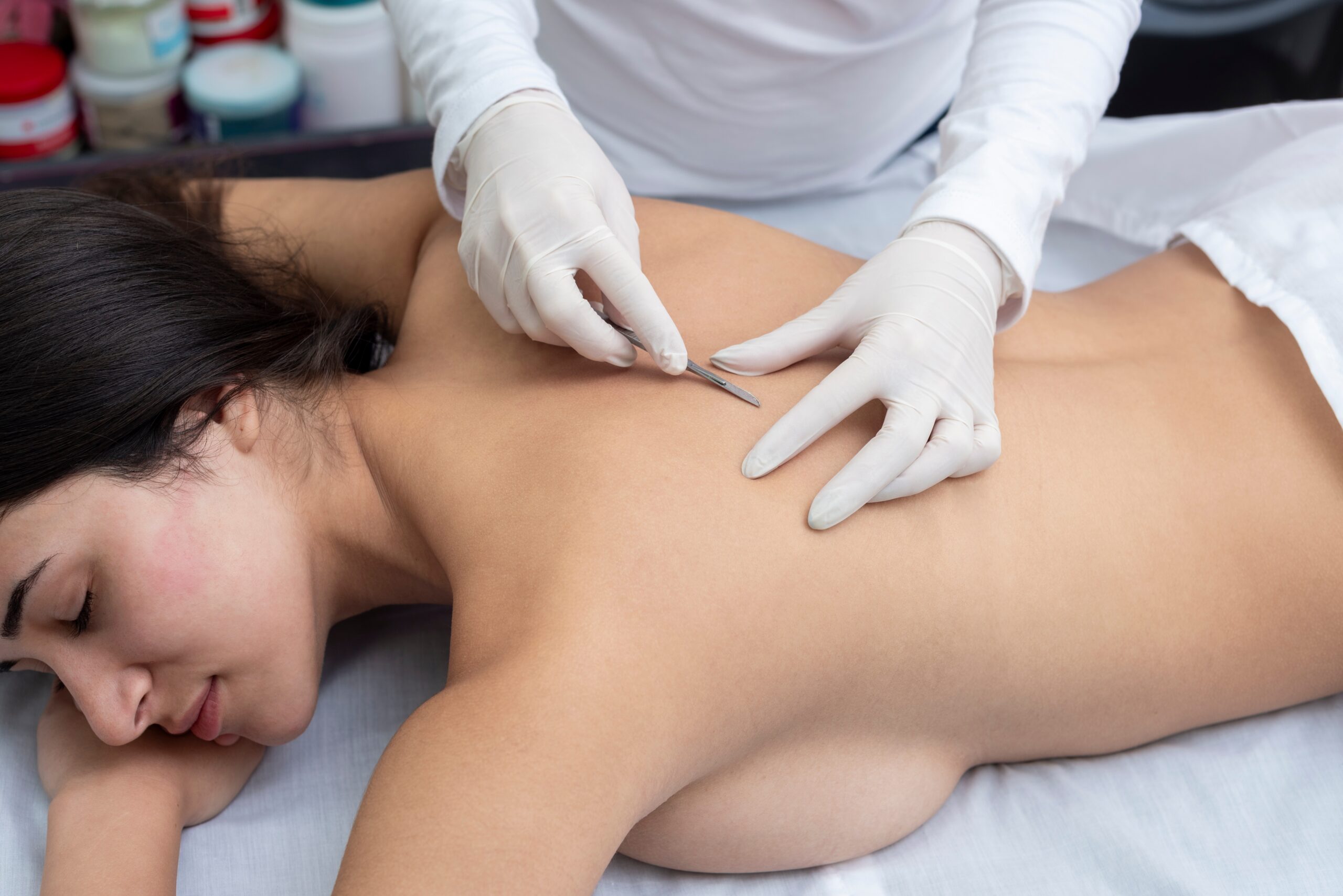 Young,Woman,On,A,Table,In,A,Beauty,Center,Performing Glowing Results Skin Spa - Dermaplaning-1