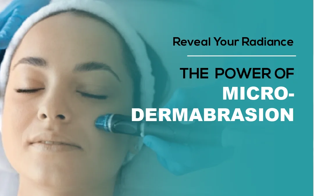 Reveal Your Radiance: The Power of Microdermabrasion