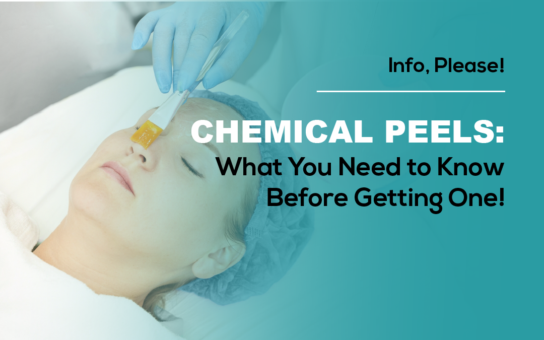 Chemical Peels: 3 Big Questions You HAVE to Ask Before Getting One!