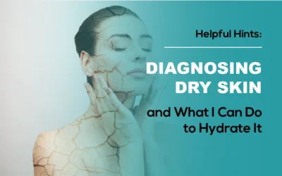 Diagnosing Dry Skin and What I Can Do to Hydrate It