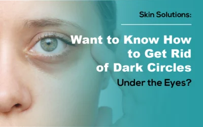 Want to Know How to Get Rid of Dark Circles Under the Eyes?