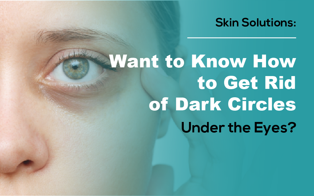 Want to Know How to Get Rid of Dark Circles Under the Eyes?