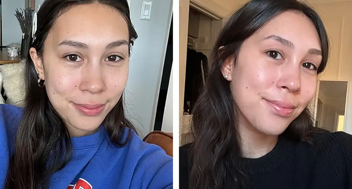 Dr. Dennis before and after eye treatment mask