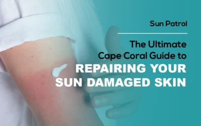 The Ultimate Cape Coral Guide to Repairing Your Sun Damaged Skin