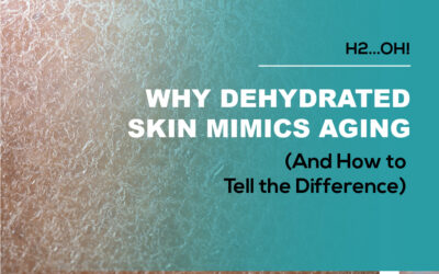 How Dehydrated Skin Mimics Aging (And How to Tell the Difference)