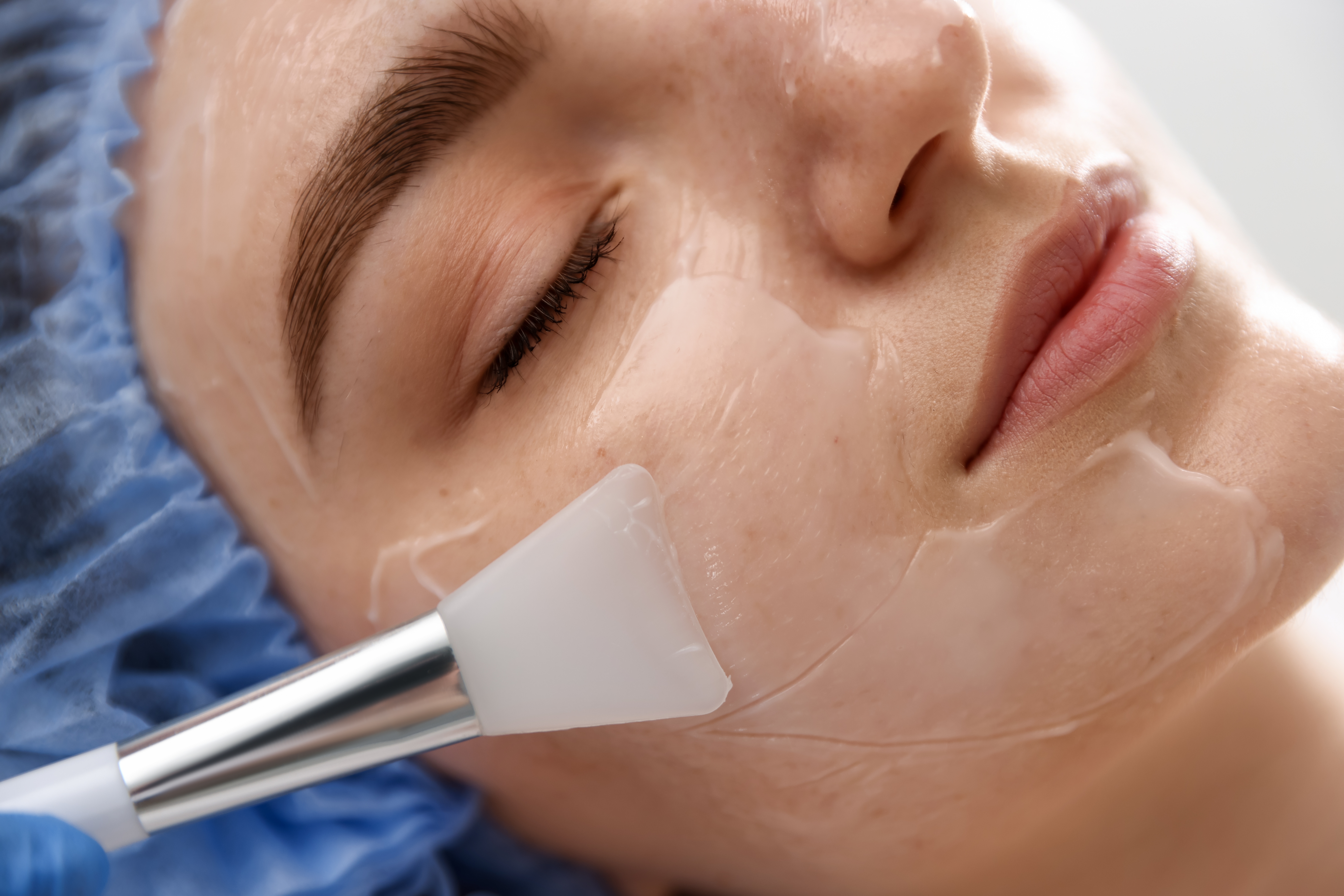 Close up of a woman receiving a professional facial exfoliation treatment for healthy, glowing skin.