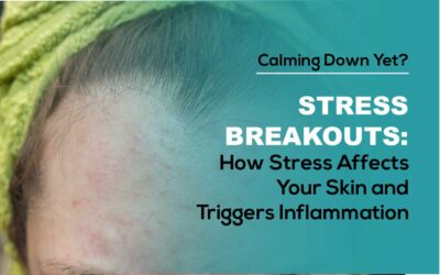 Stress Breakouts: How Stress Affects Your Skin and Triggers Inflammation