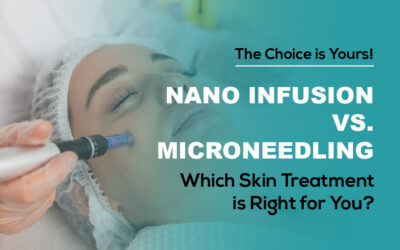 Nano Infusion vs. Microneedling: Which Skin Treatment Is Right for You?