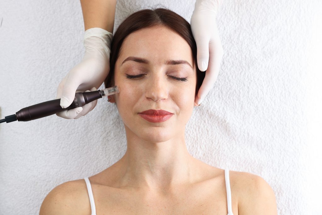 Esthetician performing a professional micro-needling treatment on client.